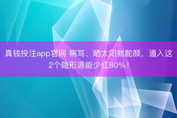 真钱投注app官网 病笃、晒太阳就酡颜,遁入这2个隐形源能少红80%!