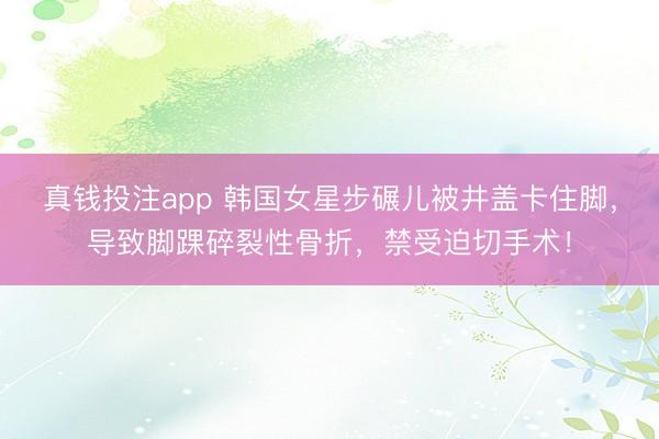 真钱投注app 韩国女星步碾儿被井盖卡住脚，导致脚踝碎裂性骨折，禁受迫切手术！